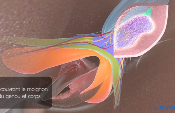 chirurgie réparatrice du clitoris après une excision